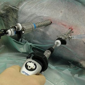 Laparoscopic Surgery
